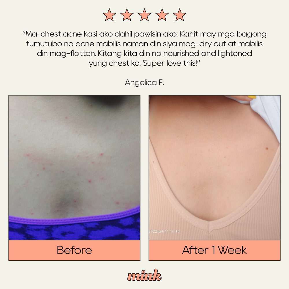 Prettits Boob Mask 300g [Limited Edition Christmas Bottles]