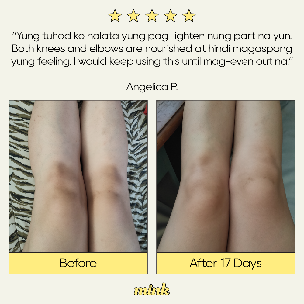 Bring Knee to Life Elbow and Knee Serum 30ml