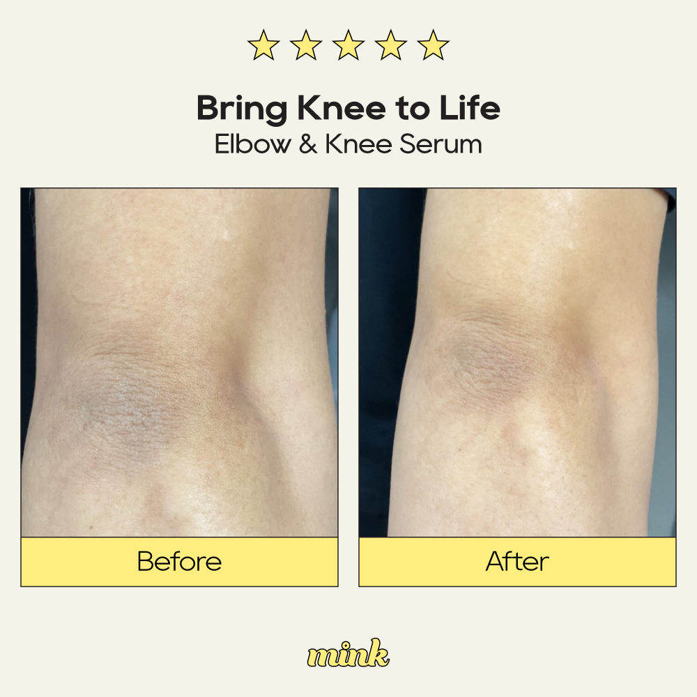 Bring Knee to Life Elbow and Knee Serum