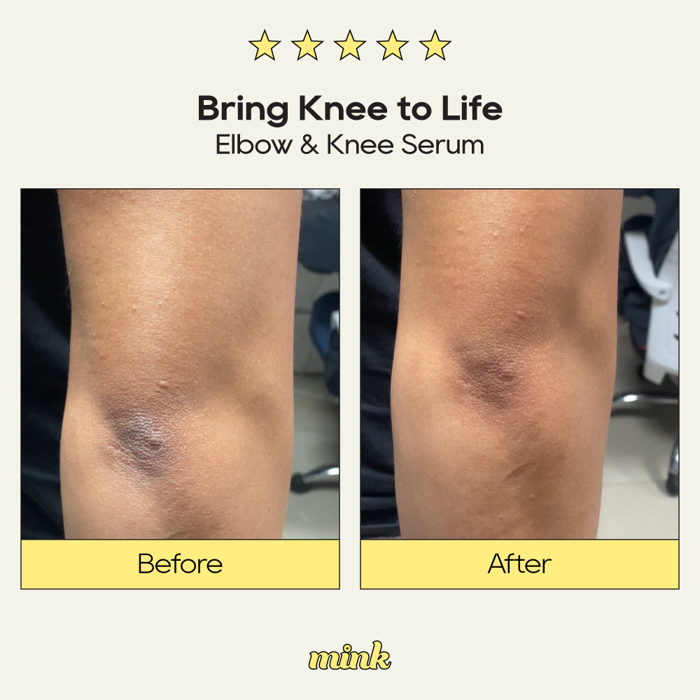 Bring Knee to Life Elbow and Knee Serum 30ml