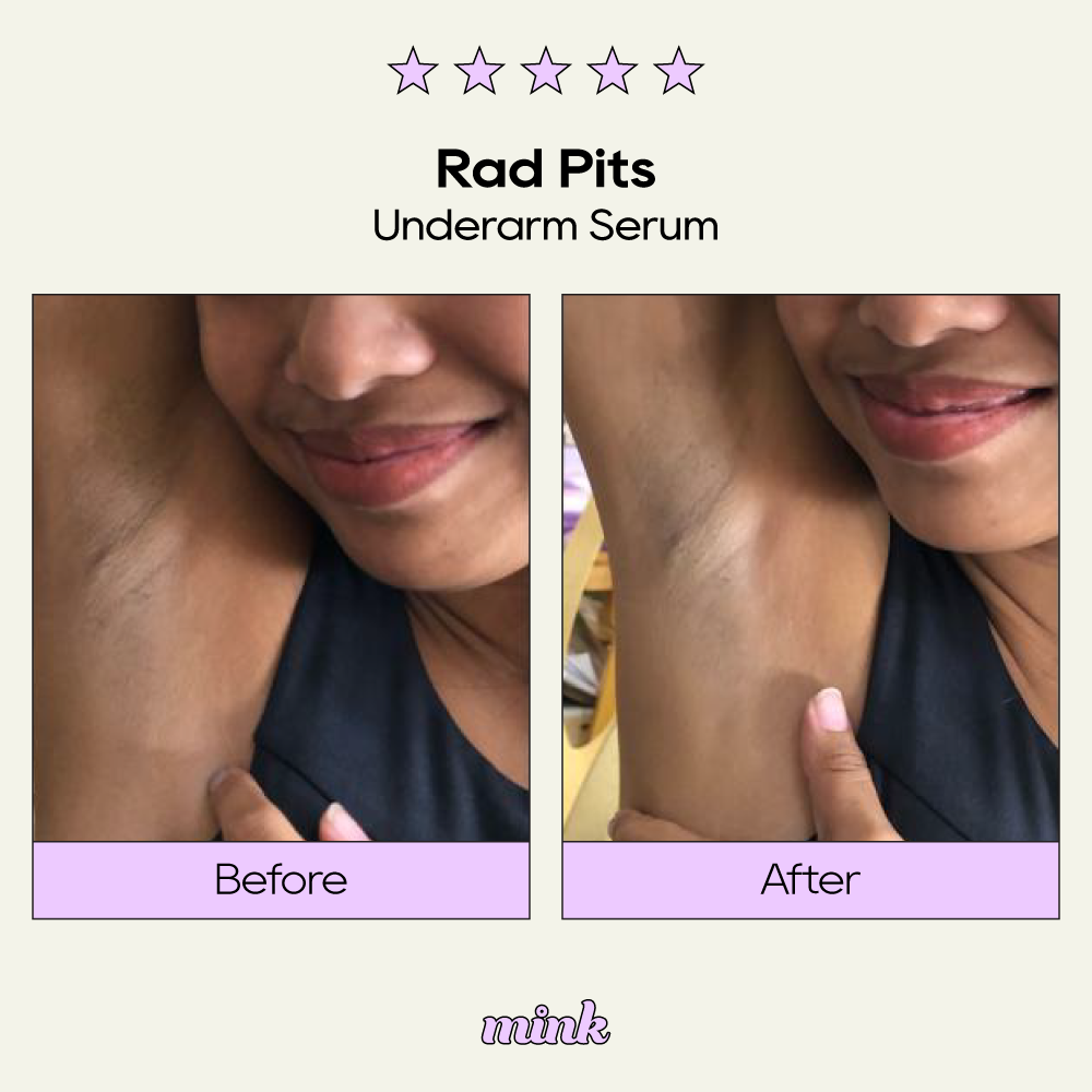 Rad Pits Underarm Serum 30ml